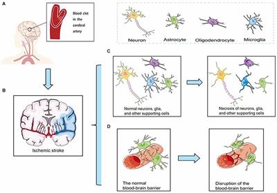Recent Advances in Nanomaterials for Diagnosis, Treatments, and Neurorestoration in Ischemic Stroke